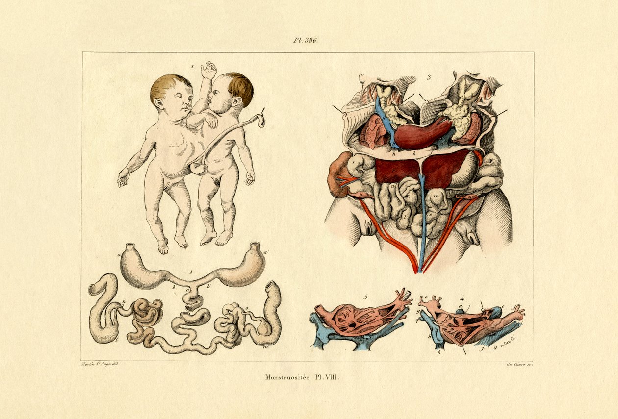 Freak, 1833-39 af French School
