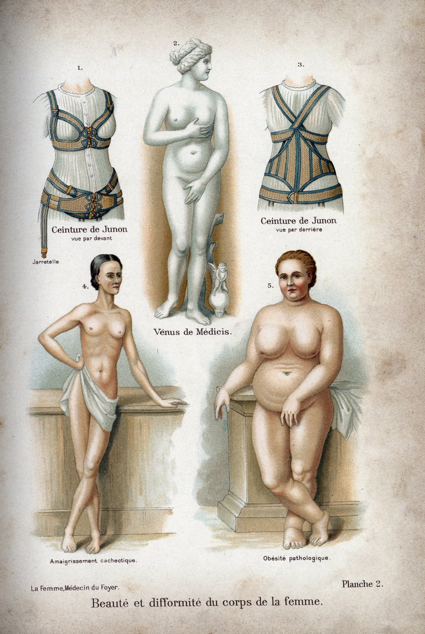 Skønhed og deformitet af kvindekroppen: en kvinde, der er for tynd, og en overvægtig repræsenteret under Venus de Medicis, der betragtes som "idealkvinden". af French School