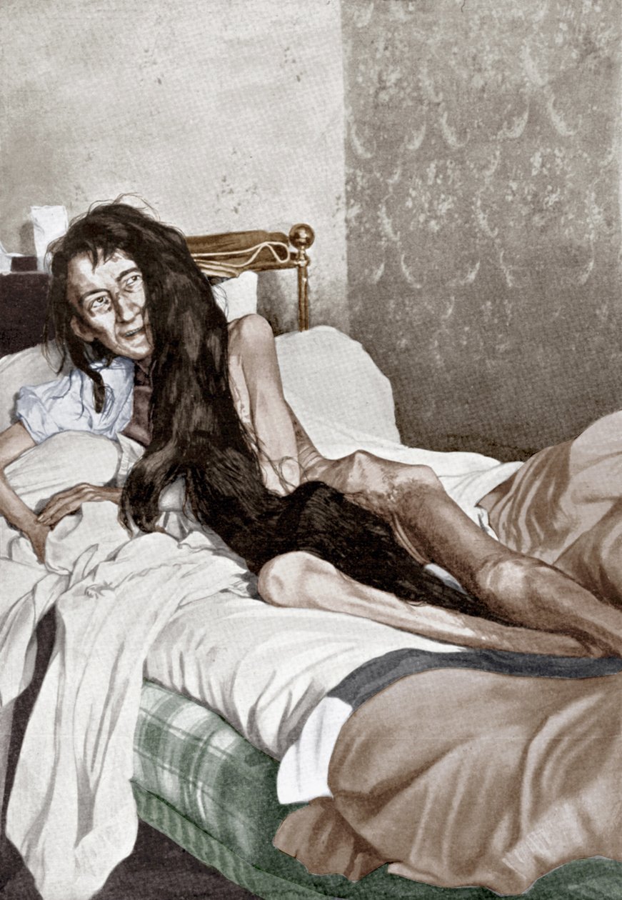 Blanche Monnier på hospitalet, Poitiers, juni 1901 (tryk) af French School