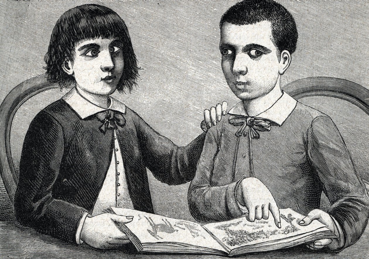 Børn med konvergent og divergerende skelning eller krydsede øjne (gravering) 1888 af French School