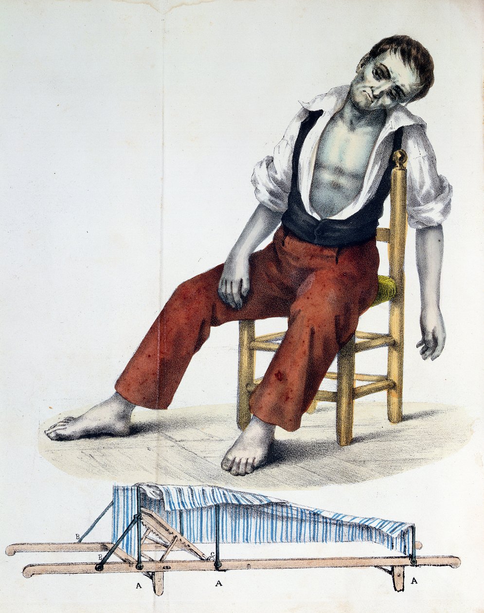 Cholera Morbus, fra Relation, History, Statistics and Medicine of Cholera-Morbus af Francisco dAssis de Souza Vaz, 1833 af French School