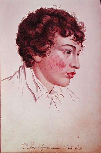 Tør plaster, fra 