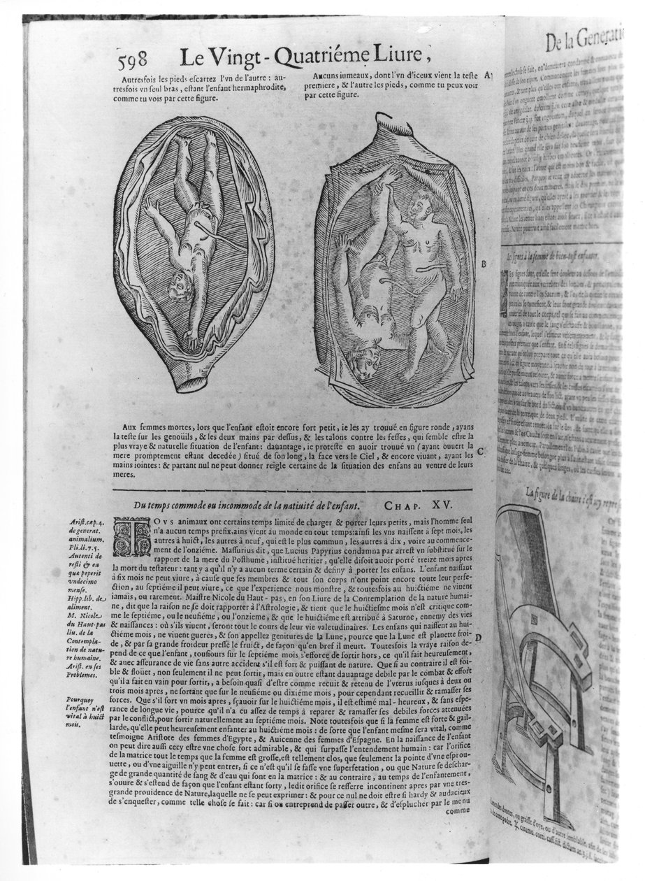 Foetus, illustration fra Oeuvres af Ambroise Pare (1509-90) udgivet i Lyon, 1641 af French School
