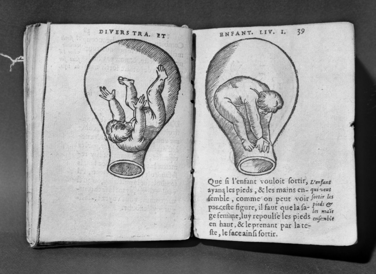 Foster i livmoderen, illustration fra det såkaldte Rhodion-manuskript af French School
