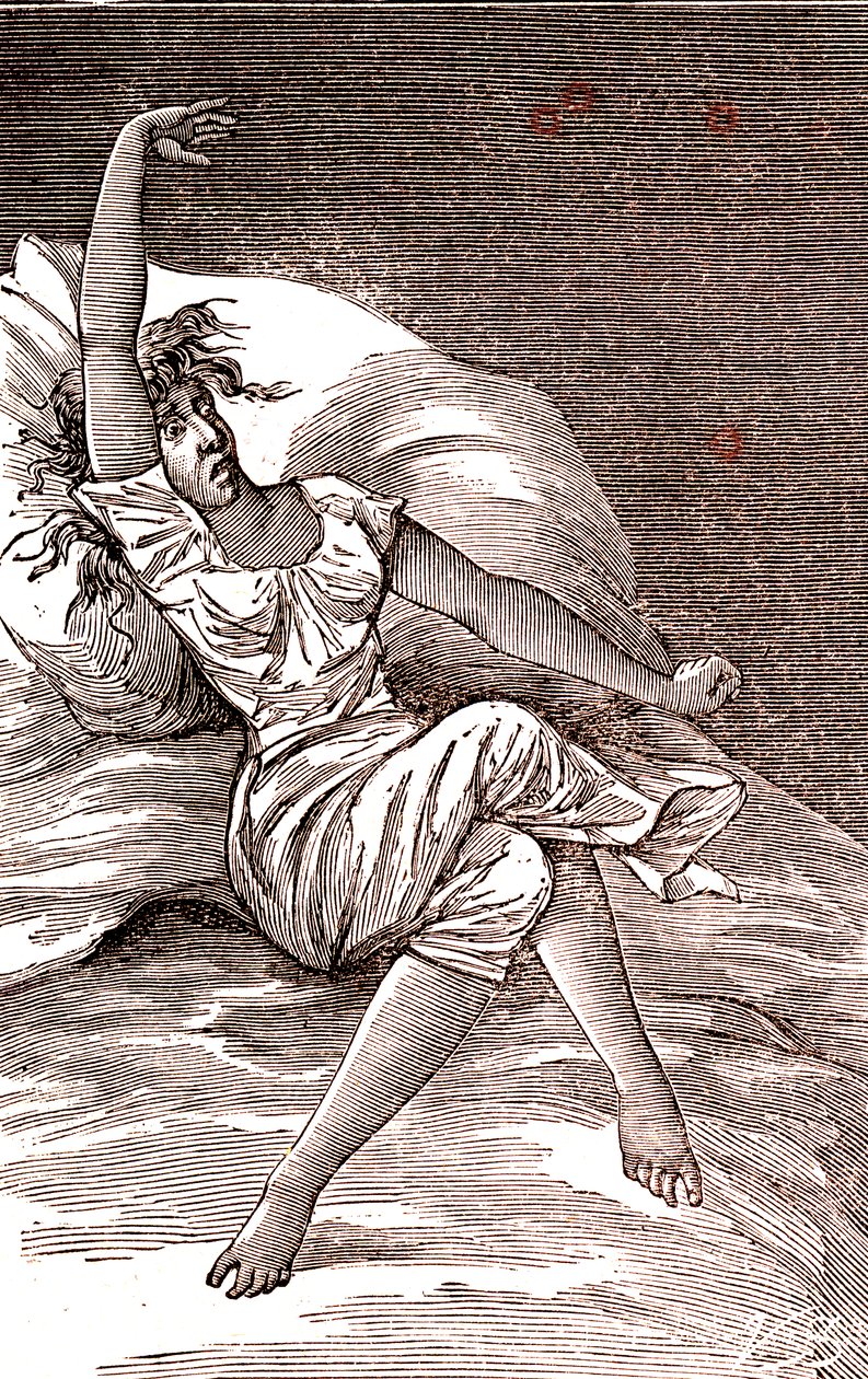 Hovedpine, melankoli og hysteri, angst. 1887 (gravering) af French School