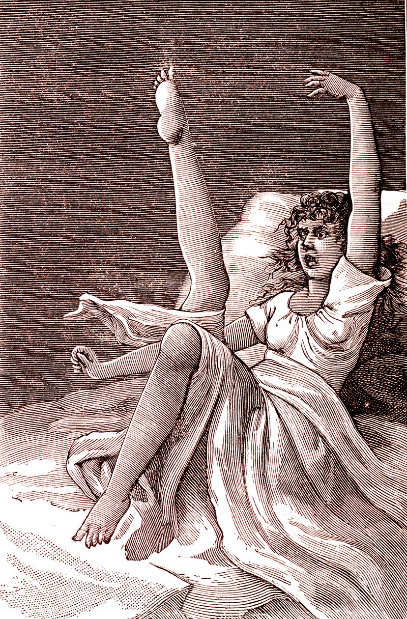 Hysteri, et ekstremt mentalt fænomen, psykoser og psykoneurose.1887 (gravering) af French School