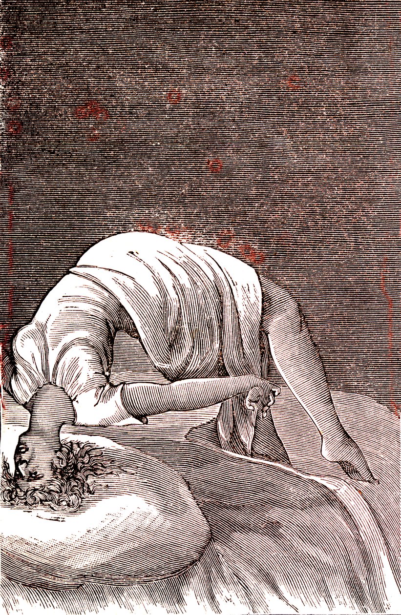 Hysteri, mental og nervøs lidelse, der stammer fra intens angst. 1887 (gravering) af French School