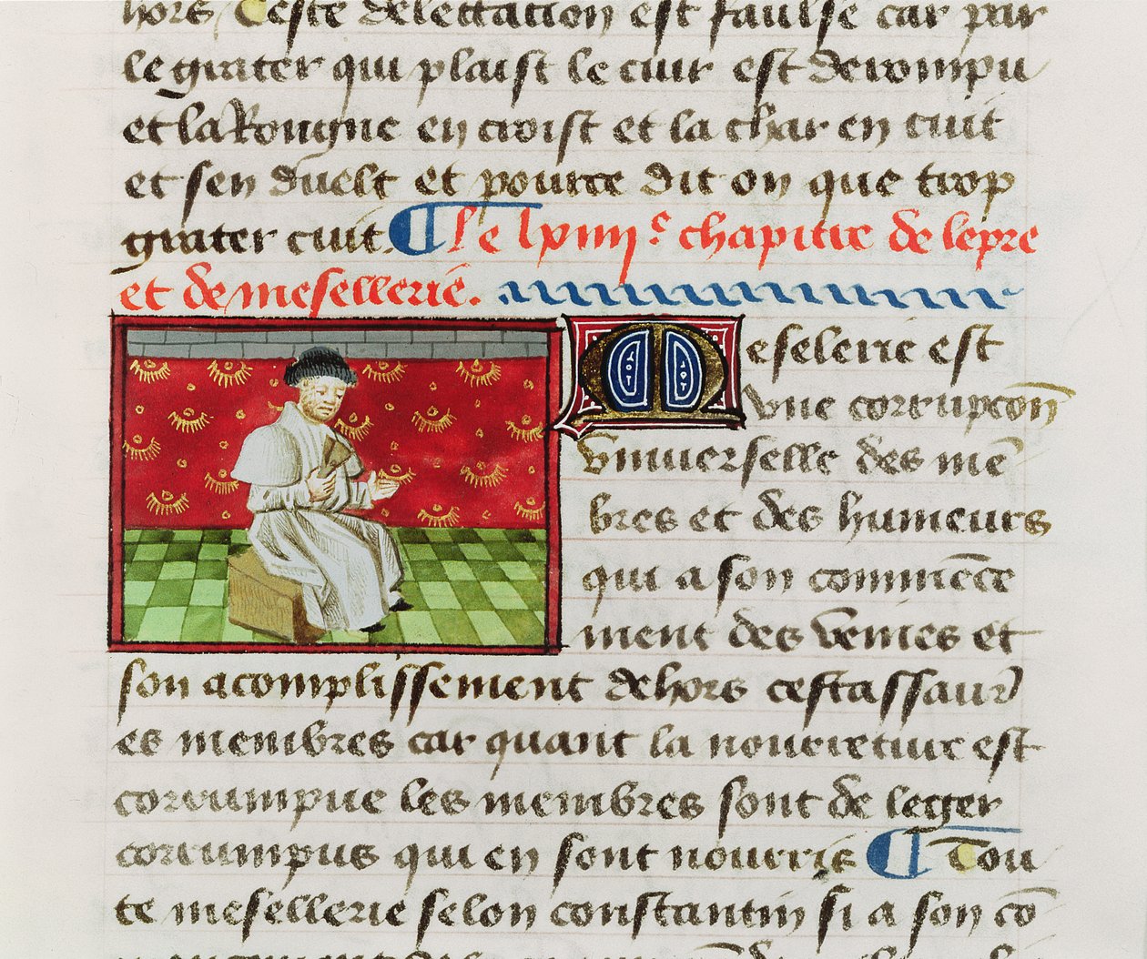 Ms.Fr.22532 Fol.118 Leper, fra Bogen om tingenes egenskaber af Barthelemy lAnglais af French School