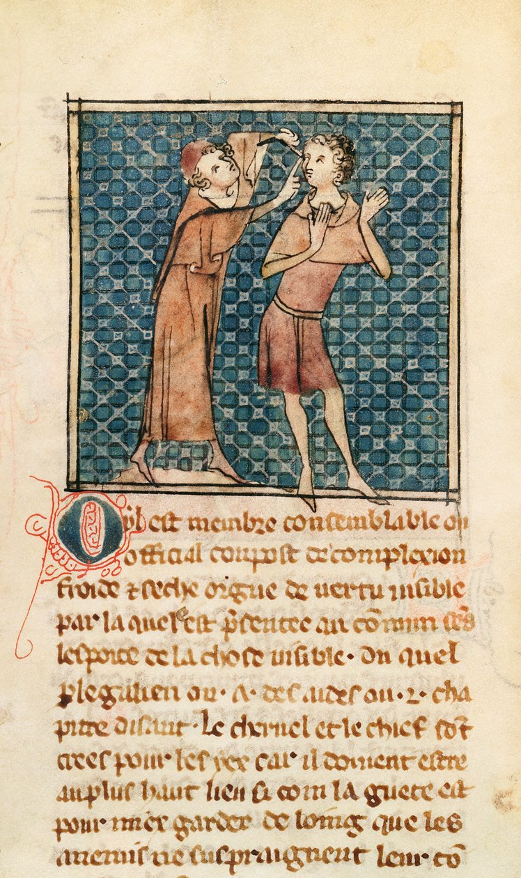 Ms 2030 fol.17 Oftalmologi, illustration fra La Chirurgie de Maitre Henri de Mondeville af French School