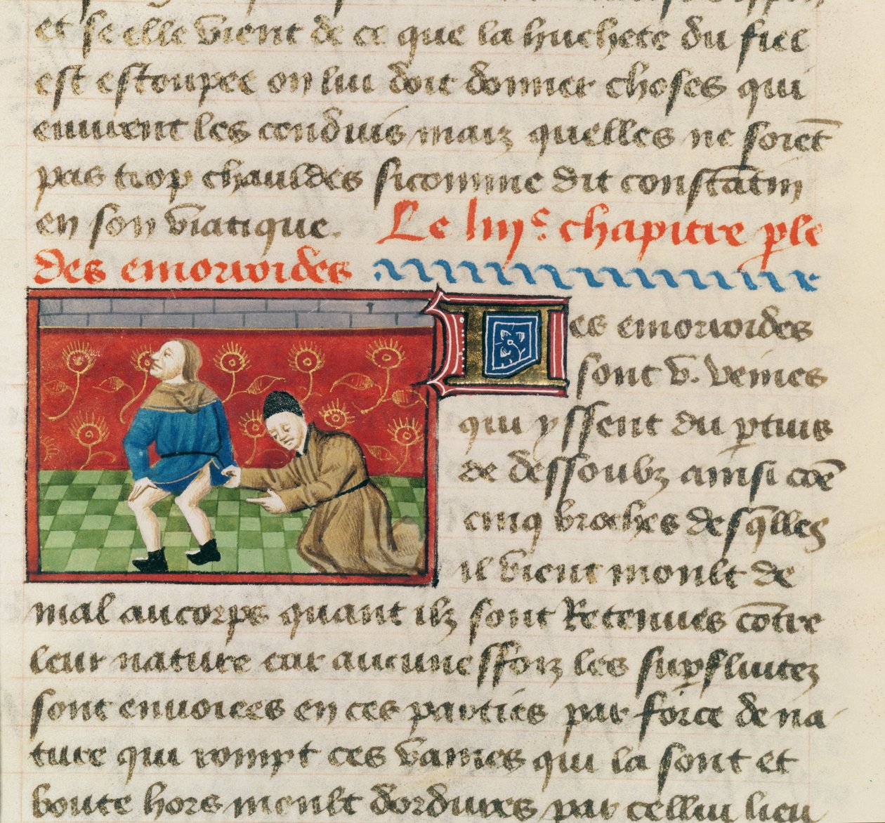 Ms 22532 Undersøgelse af en patient med hæmorider, fra Le Livre des Proprietes des Choses af Barthelemy lAnglais, ca. 1410-15 af French School