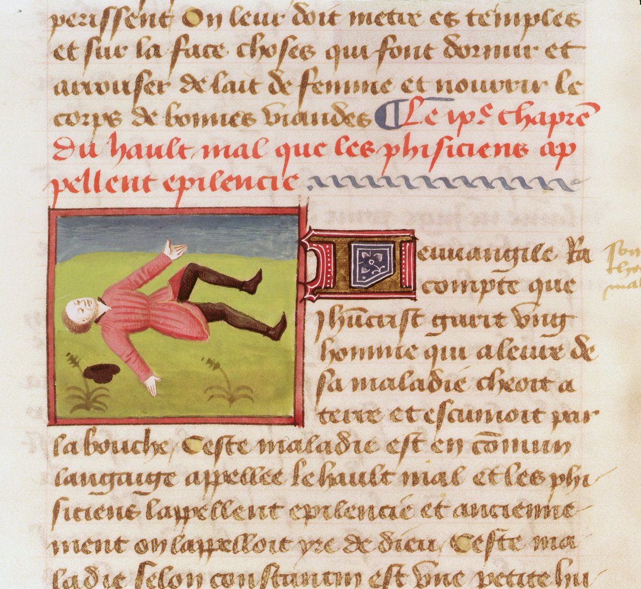 Fru 22532 Patient, der lider af et epileptisk anfald, fra The Book of the Properties of Things af Barthelemy langlais, ca. 1410-15 af French School