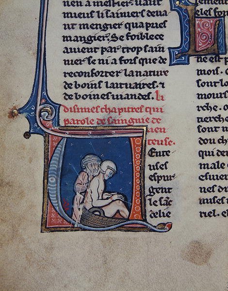 Ms 2510 Auskultation af en syg mand (vellum) af French School