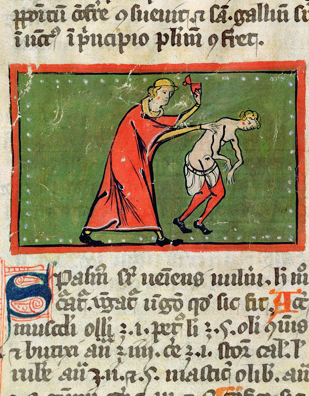 Ms H 89 Læge behandler en patientryg, fra en udgave af Book of Surgery af Rogier de Salerne af French School