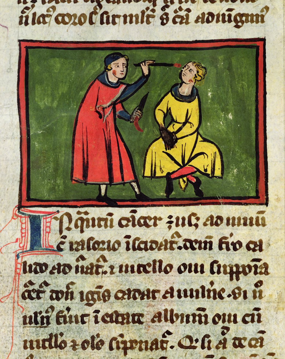 Ms H 89 Kirurgisk behandling, fra en udgave af Book of Surgery af Rogier de Salerne af French School
