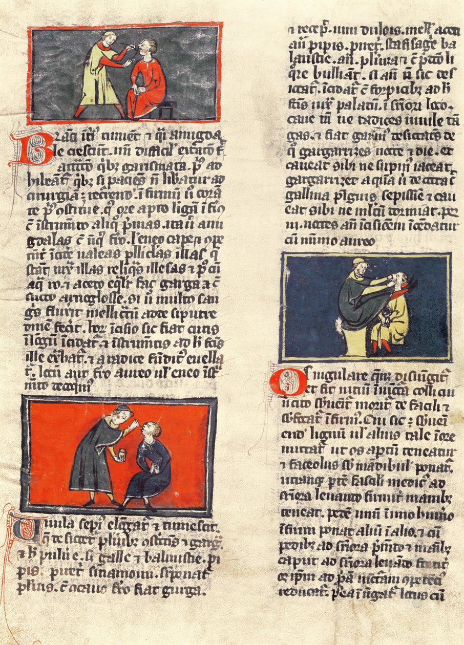Ms H 89 fol.16v Dental Surgery, fra en udgave af 