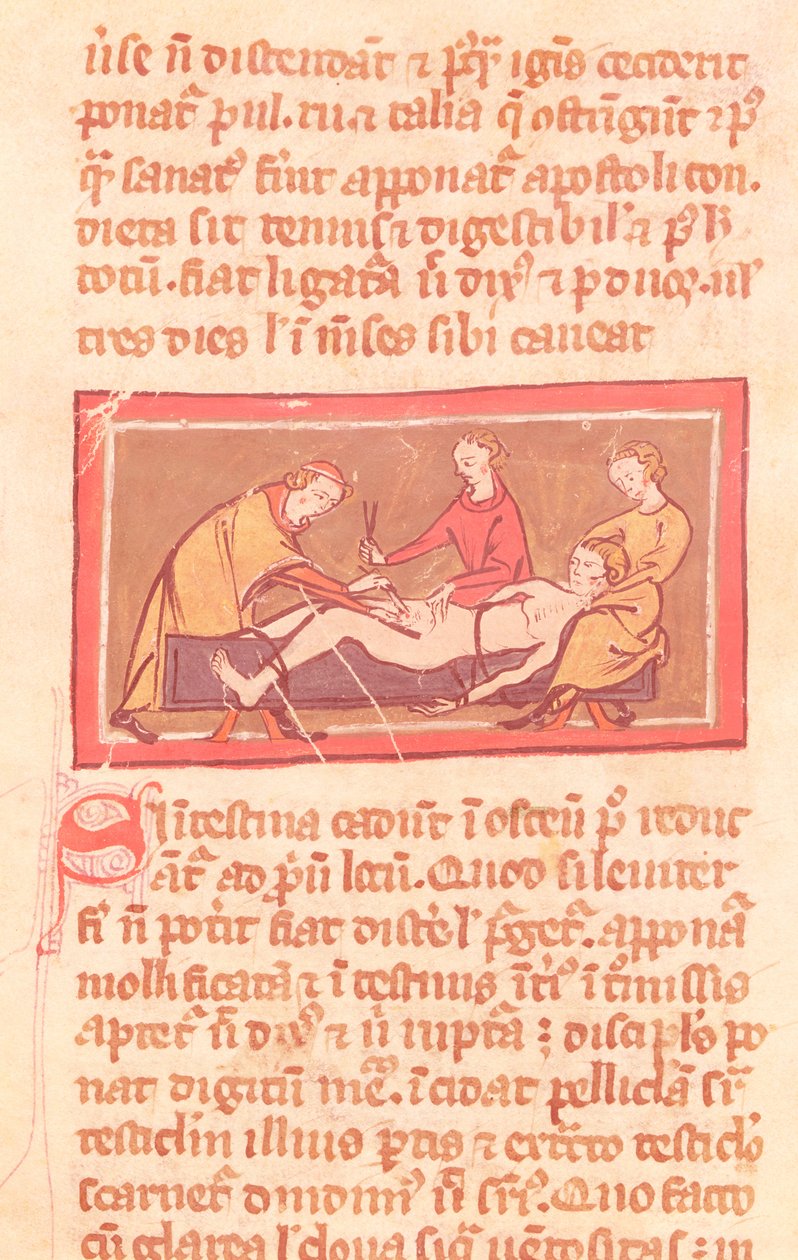 Ms H 89 fol.23 Kirurgi, fra en udgave af Kirurgibogen af Rogier de Salerne af French School