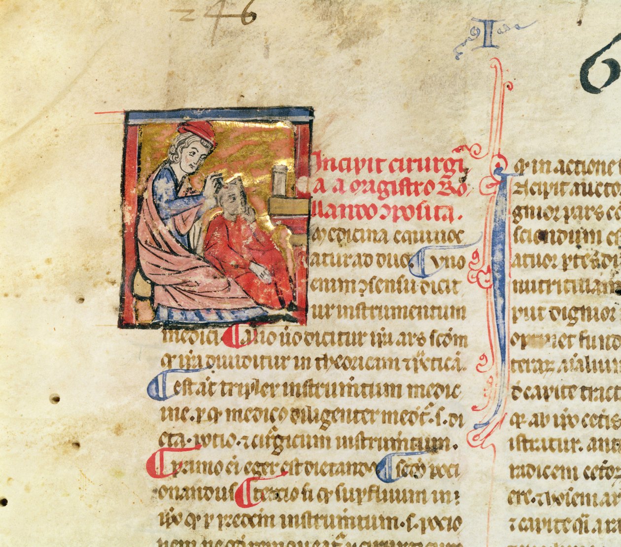 Fru Lat. 7134 fol.1 Trepanation, fra Kirurgi af Maitre Rolandi af French School