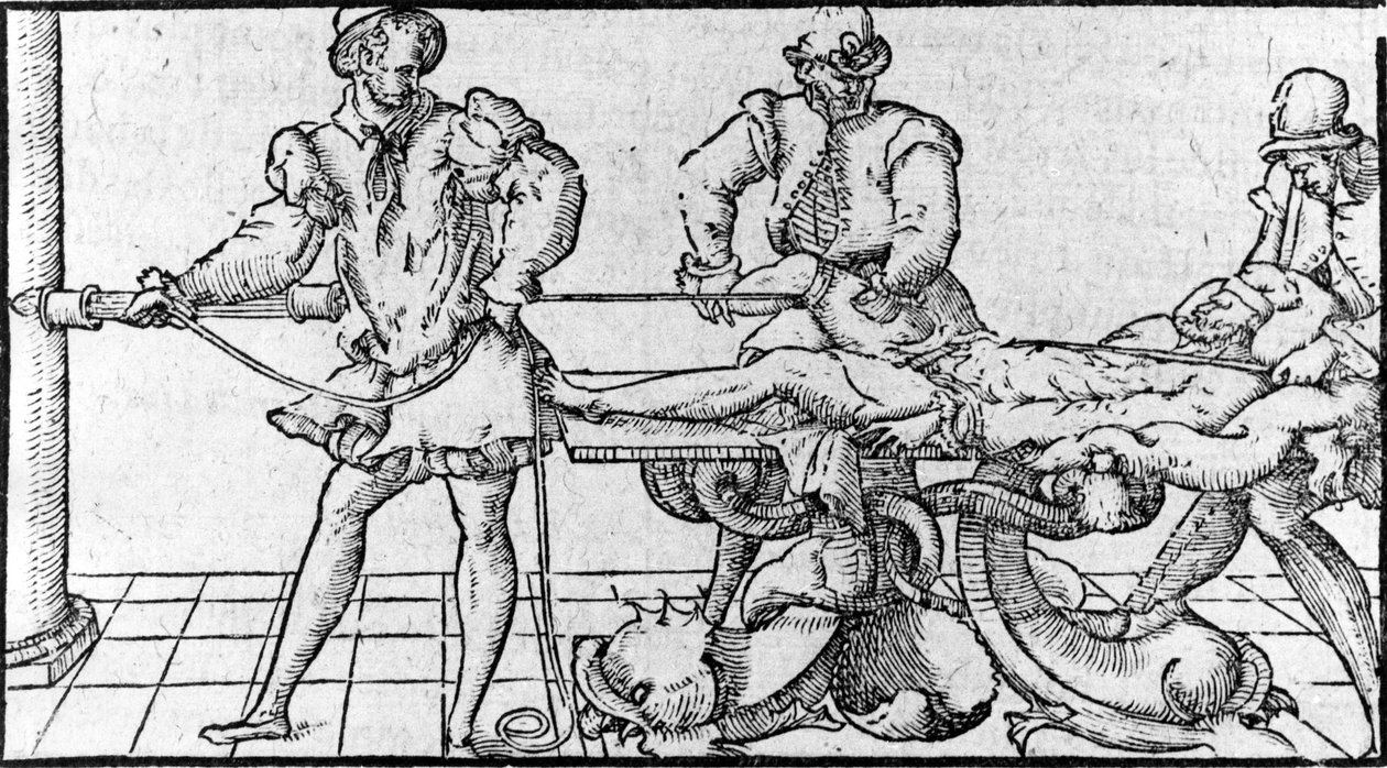 Reduktion af dislokation, -i "Medical Treaty of Ambroise Paré"", omkring 1560. af French School
