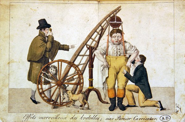 "De vidunderlige virkninger af tandbøjler", ca. 1790 (farvelitografi) af French School