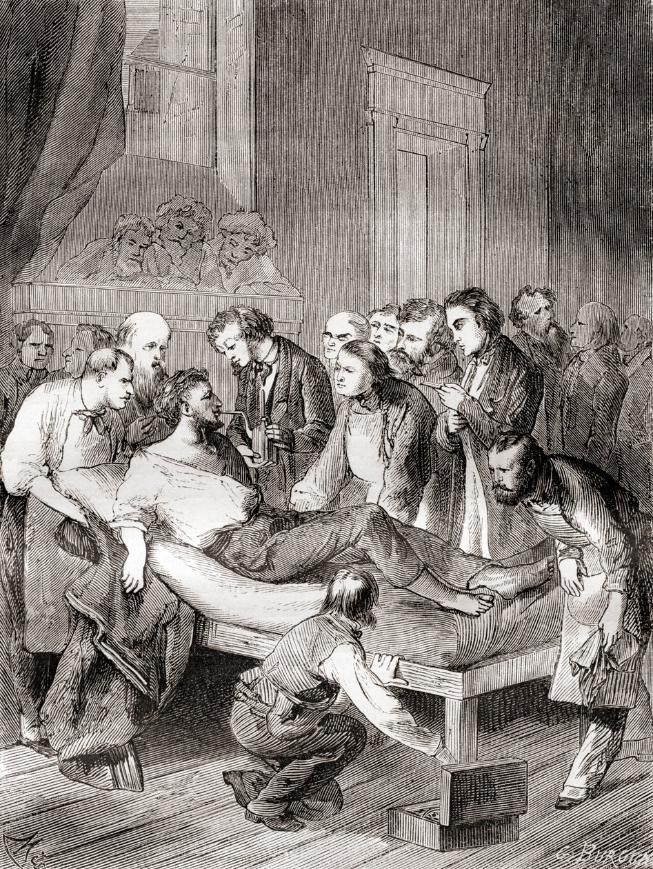 Den første offentlige demonstration af brugen af inhaleret ether som et kirurgisk bedøvelsesmiddel i 1846 af en amerikansk tandlæge, William Thomas Green Morton, fra 