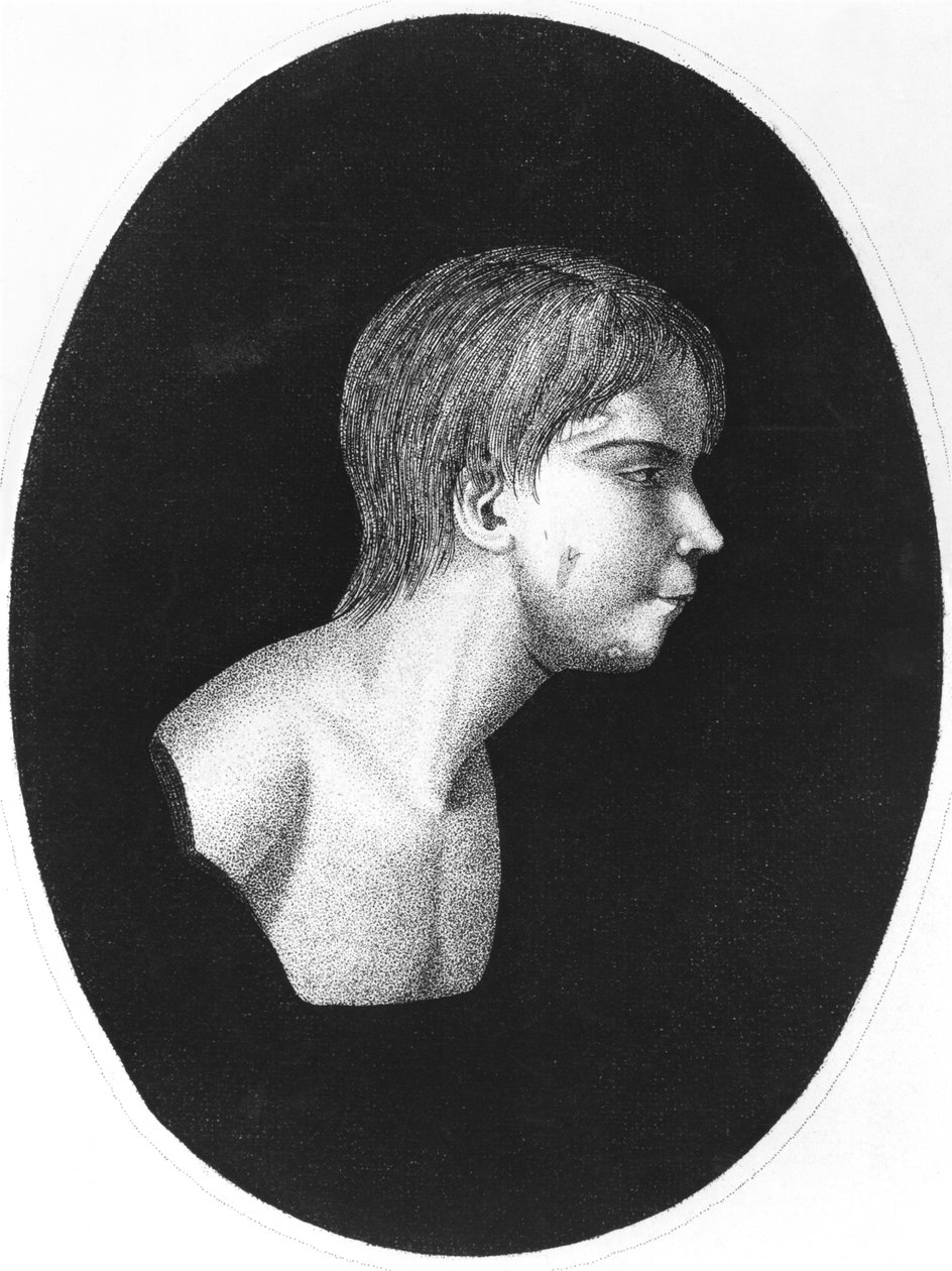 Victor of Aveyron, frontispice af De lEducation dun homme sauvage af J.E.Itard af French School