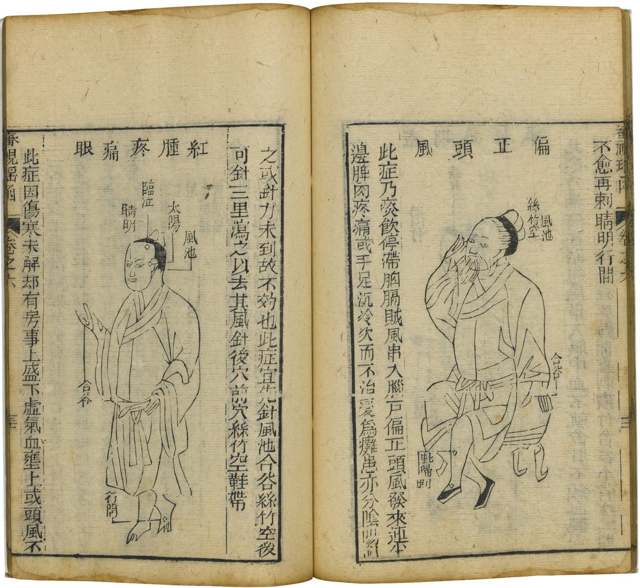 Shen Shi Yao Han A Precious Book of Ophthalmology, 1644 af Fu Renyu