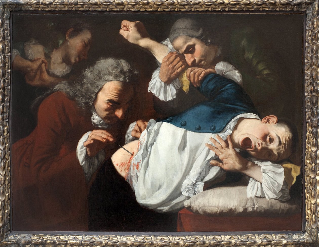 Operation. Maleri af Gaspare Traversi (ca. 1722-1770), olie på lærred, ca. 1753-1754. Italiensk kunst 1700-tallet. Staatsgalerie Stuttgart (Tyskland). af Gaspare Traversi