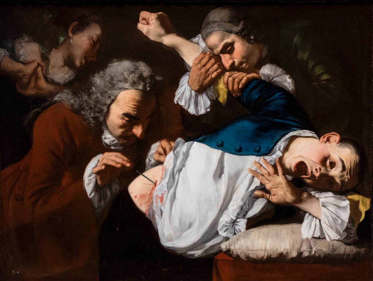 The Operation, ca. 1753/54 (Olie på lærred) af Gaspare Traversi