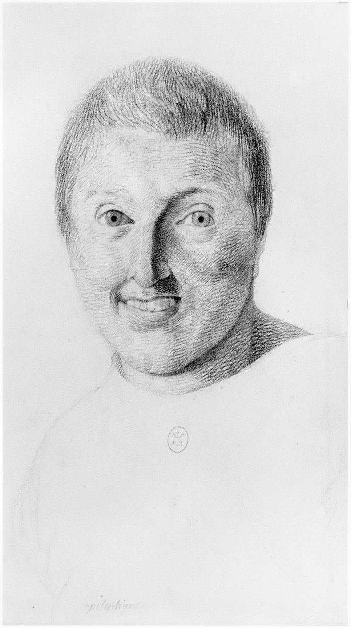 Epileptisk kvinde, set forfra, illustration fra en upubliceret afhandling af Jean Etienne Dominique Esquirol (1772-1840) om galningerne på Salpetriere-asylet, ca. 1818 af Georges Francois Gabriel