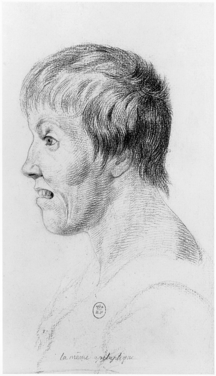 Epileptisk kvinde, profil, illustration fra en upubliceret afhandling af Jean Etienne Dominique Esquirol (1772-1840) om galningerne på Salpetriere-asylet, ca. 1818 af Georges Francois Gabriel