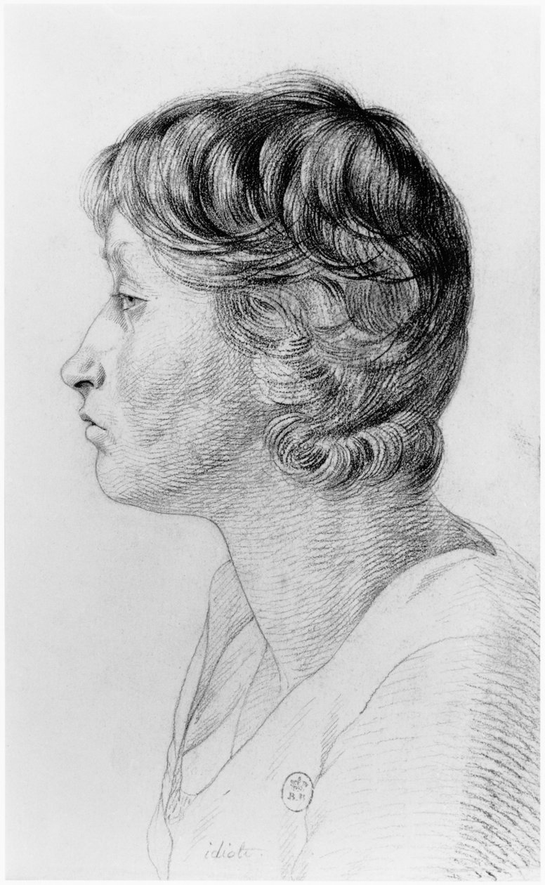 Idiot, illustration fra en upubliceret afhandling af Jean Etienne Dominique Esquirol (1772-1840) om de sindslidende på hospitalet Salpetriere, ca. 1818 af Georges Francois Gabriel