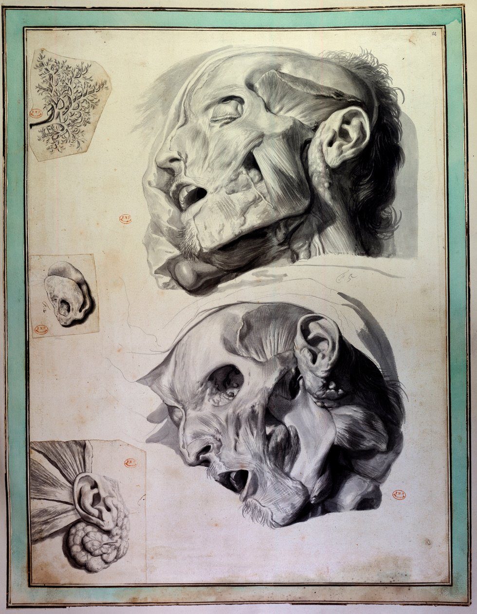 Afbarkede menneskehoveder: muskler og skeletter er synlige. Gravering af Gerard de Lairesse (1640-1711), der illustrerer "Anatomia Humani Corporis" af Govert Bidloo (eller Govard) (1649-1713) Det medicinske fakultets bibliotek fra det 18. århundrede, Paris af Gerard de Lairesse