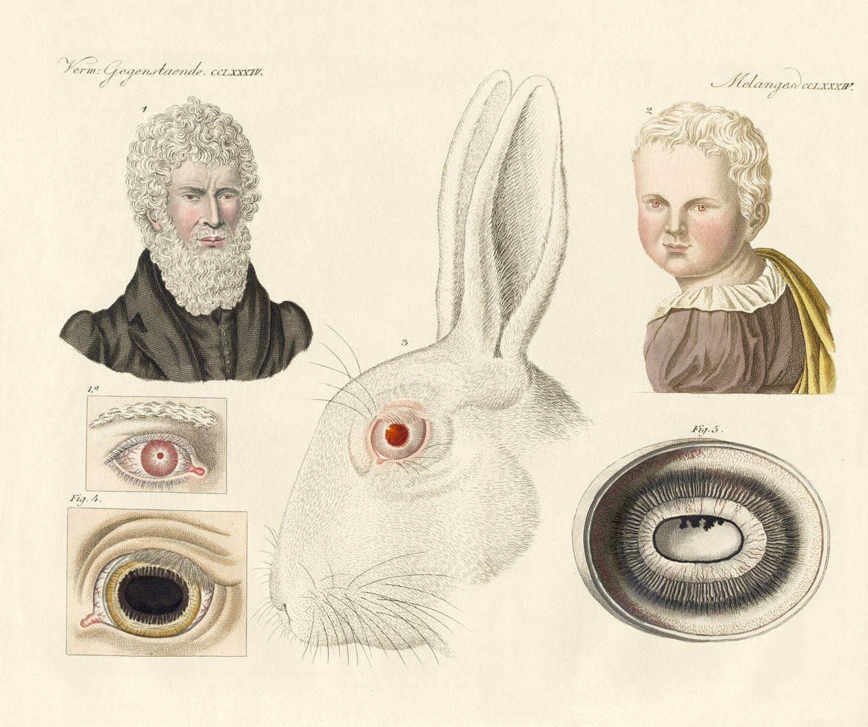 Albinoer (farvet gravering) af German School
