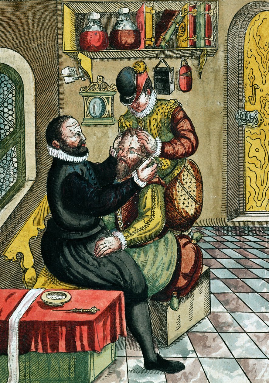 Kataraktoperation, fra Ophthalmodouleia af Georg Bartisch (1535-1636) udgivet i Dresden i 1583 (træblok i farver) af German School