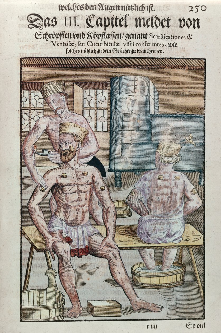 Cupping, fra Ophthalmodouleia af Georg Bartisch (1535-1636) udgivet i Dresden i 1583 (træblok i farver) af German School