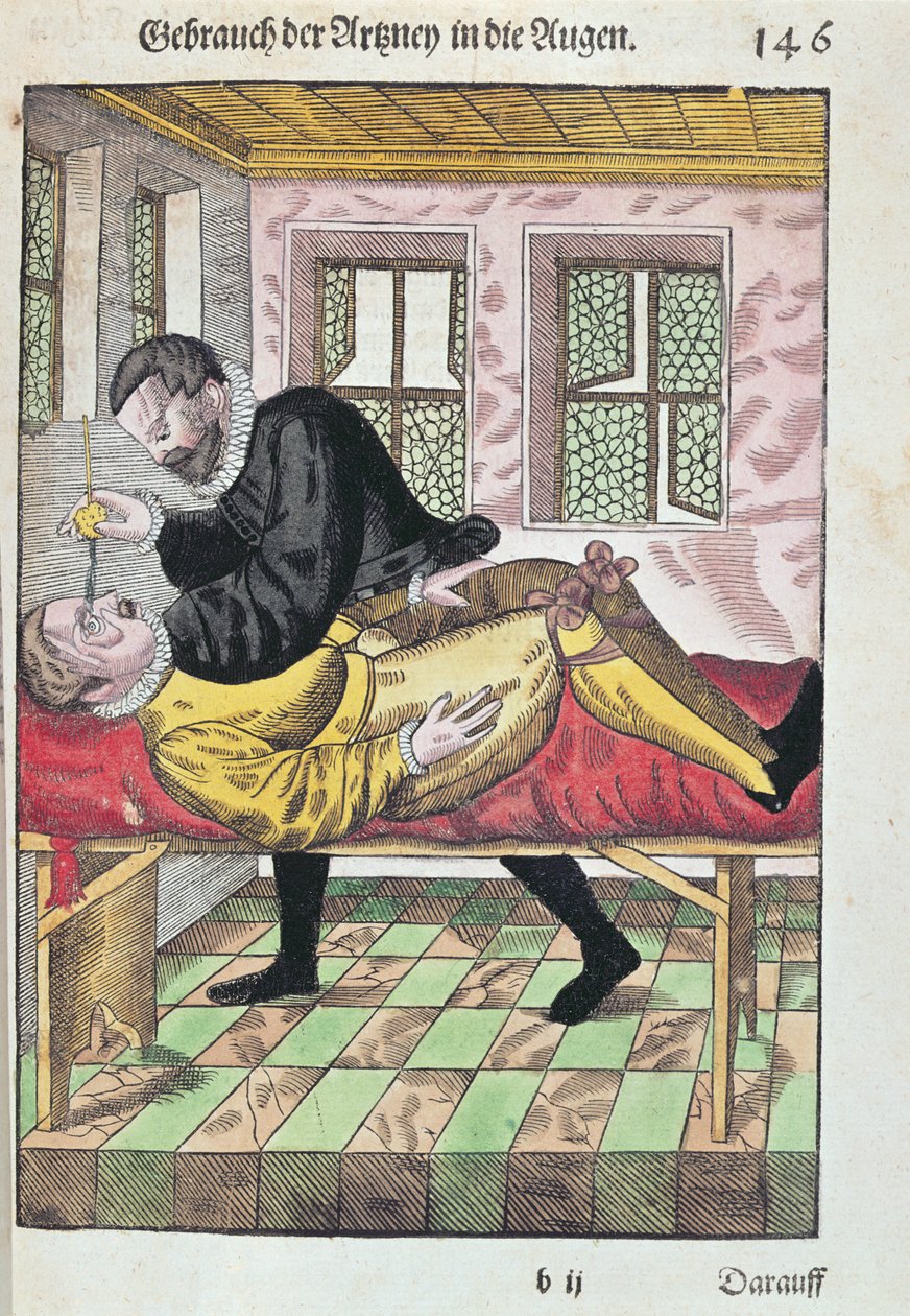 Eye Operation, fra Ophthalmodouleia af Georg Bartisch (1535-1636) udgivet i Dresden i 1583 (træblok i farver) af German School