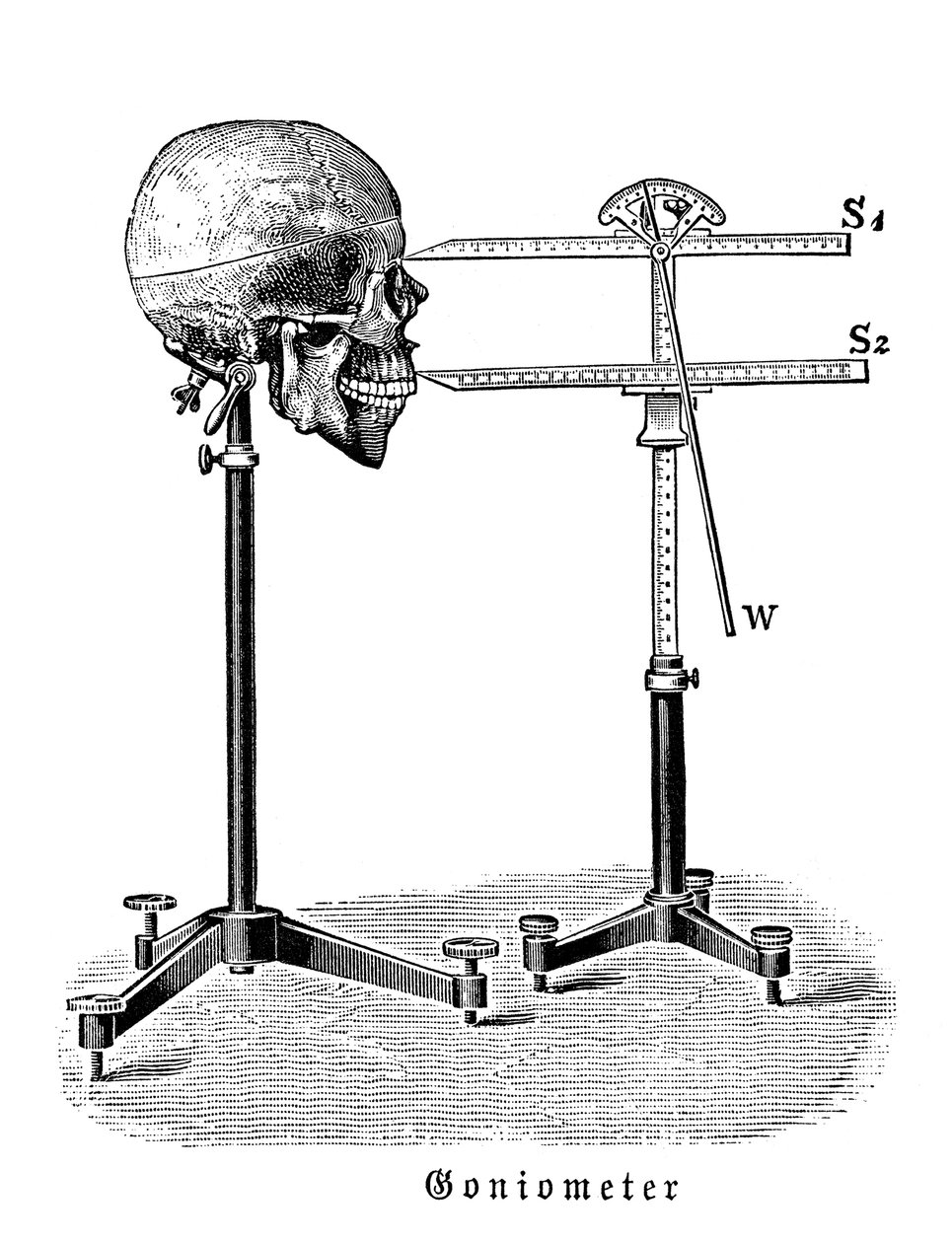 Goniometer, der måler menneskeskalle af German School