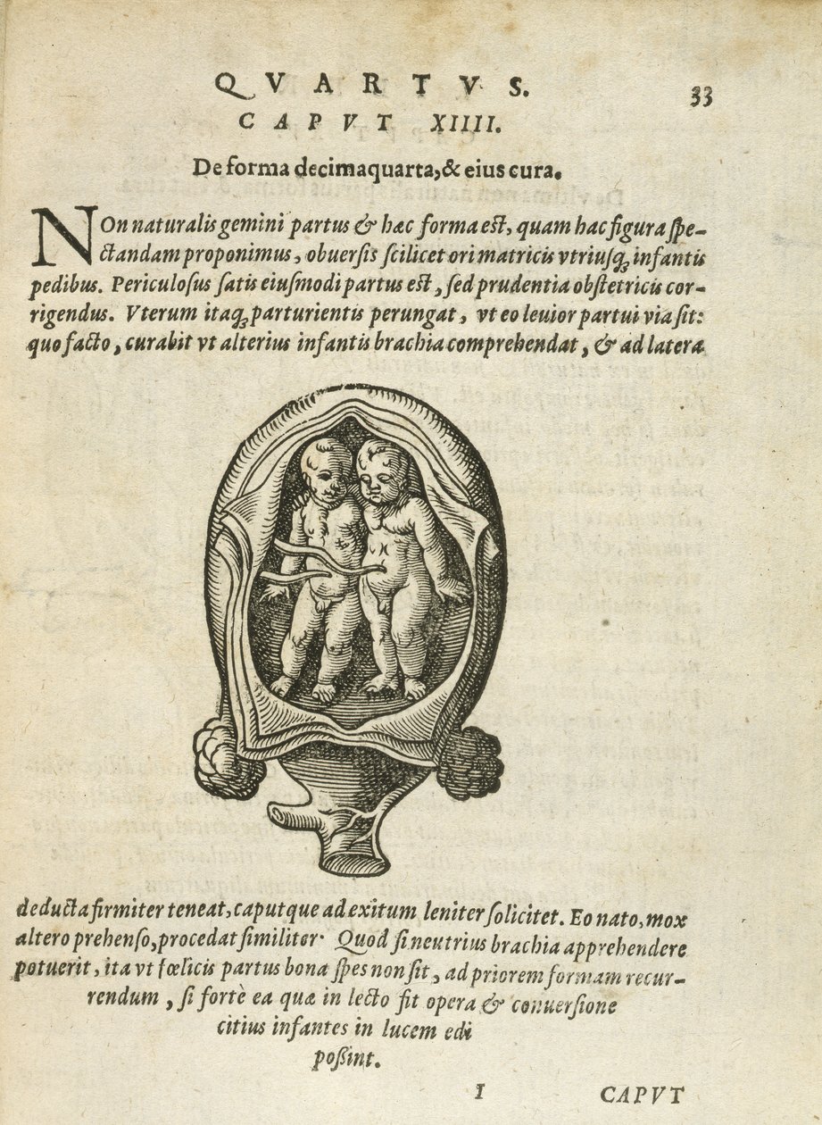 Ikke-identiske tvillinger i livmoderen, illustration fra kapitel 14, bog 4 i Om undfangelse og vækst af mennesket af Rueff, 1587 af German School
