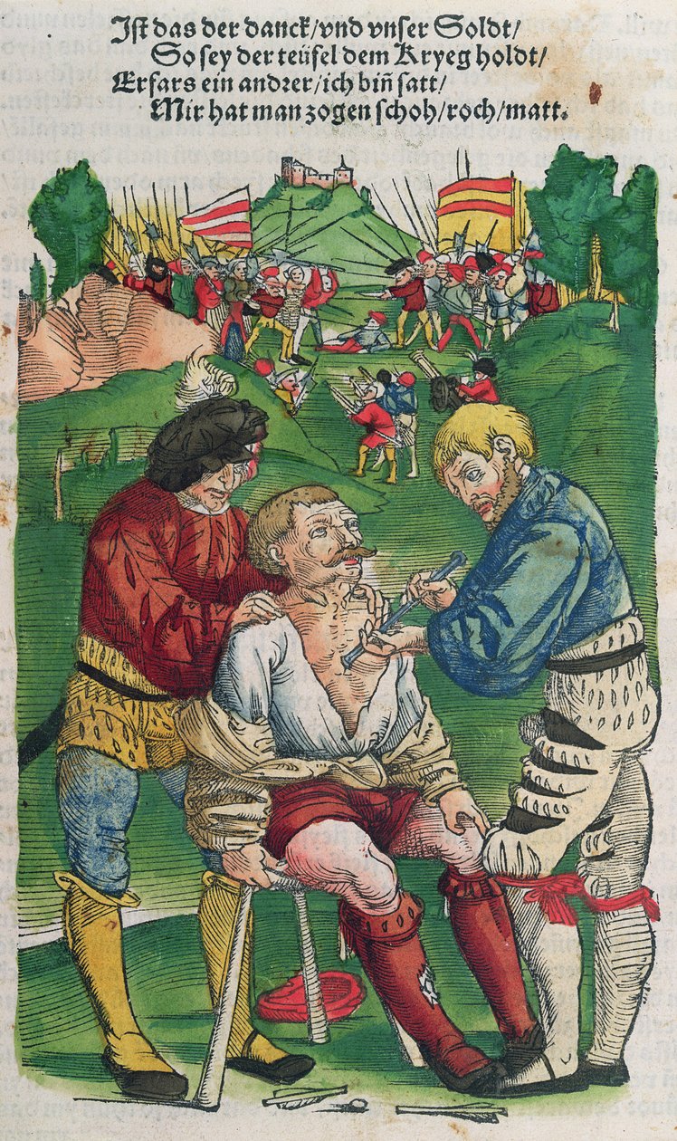 Fjernelse af en pil, illustration fra Feldtbuch der Wundartzney af Hans von Gersdorff, 1540 af German School