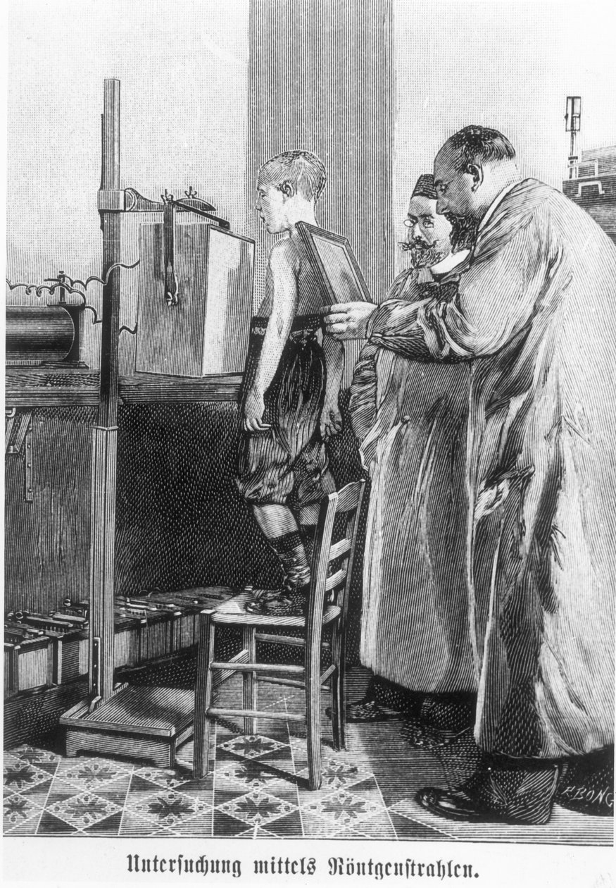 Wilhelm Konrad Roentgen (1845-1923) røntgenbilleder af en ung dreng fra en bog af Hans Kraemer, ca. 1898-99 af German School