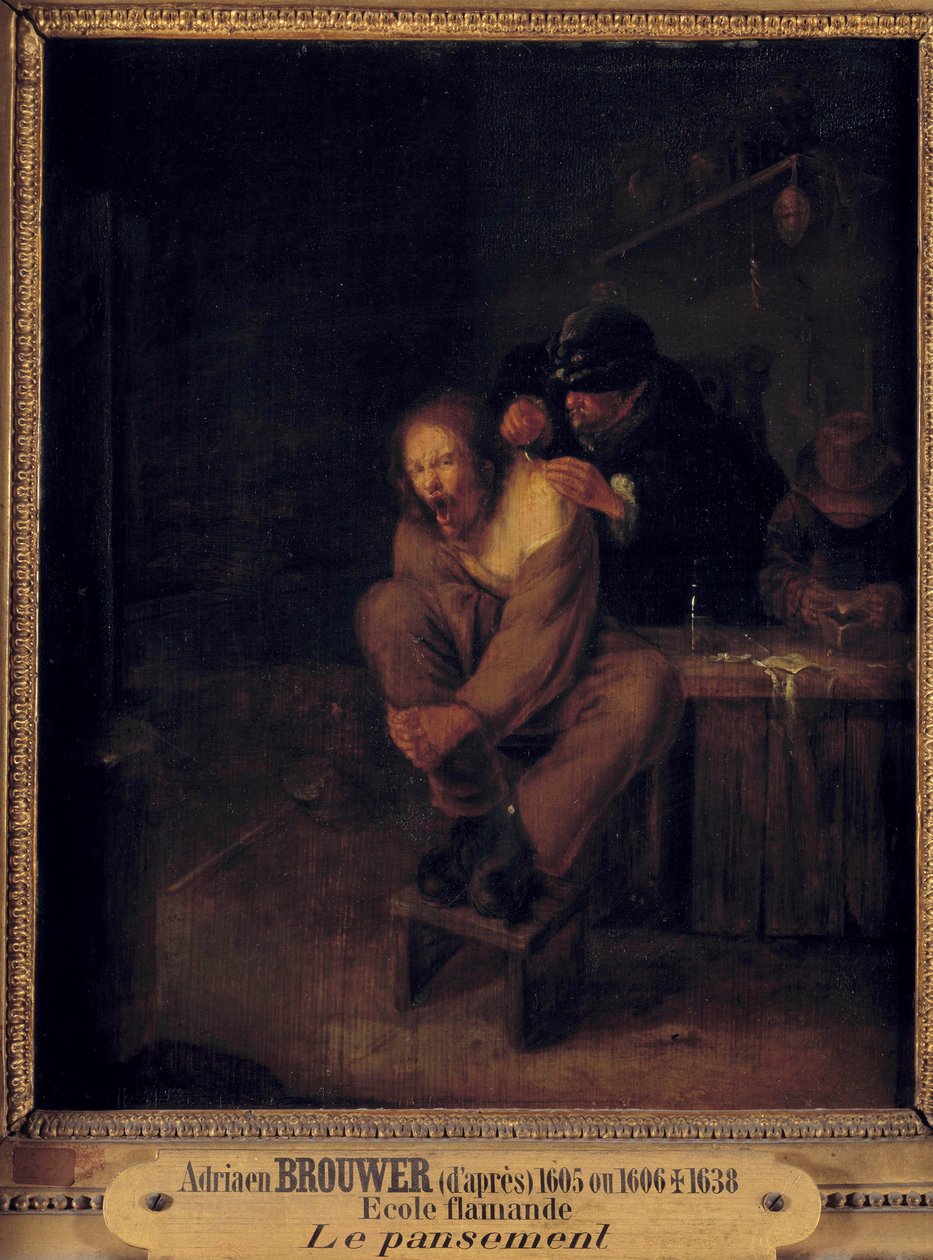 Operation (eller påklædning) En kirurg, der tager sig af en patient. Maleri af Gerrit Lundens (1622-1683) efter Adriaen Brouwer (1605/1606-1638). 17. århundrede. Svag. 0,32x0,28 m. af Gerrit Lundens