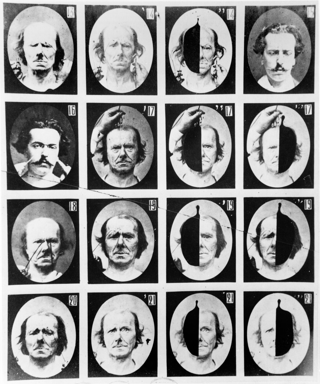 Fysiognomiske studier, fra "Mecanisme de la Physionomie humaine ou analyse electrophysiologique des passions" af Duchenne de Boulogne, udgivet 1876, Paris af Guillaume Benjamin Armand Duchenne de Boulogne
