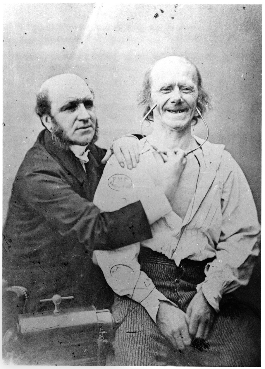 Faradisering af frontalmusklen, fra "Mecanisme de la physionomie humaine ou analyse electrophysiologique des passions" af Duchenne de Boulogne, udgivet i 1876, Paris af Guillaume Benjamin Armand Duchenne de Boulogne