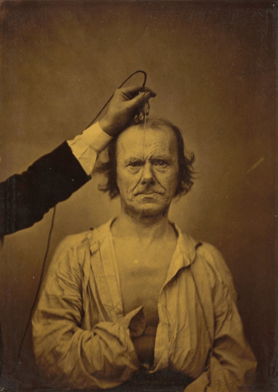 Opmærksomhed (venstre); Alvorlighed, aggression (højre),1854-1856, trykt 1862 (foto) af Guillaume Benjamin Armand Duchenne de Boulogne