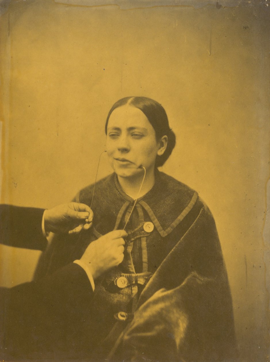 Hånlig afsky (til venstre); Hånlig latter (til højre),1854-1856, trykt 1862 (foto) af Guillaume Benjamin Armand Duchenne de Boulogne