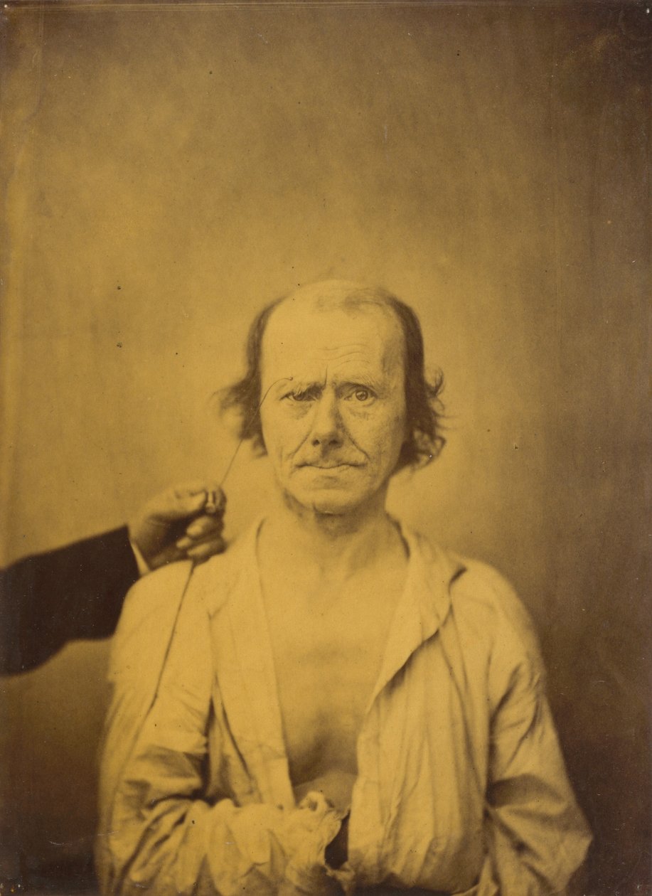 Opmærksomhed (venstre); Refleksion (højre) af Guillaume Benjamin Amant Duchenne