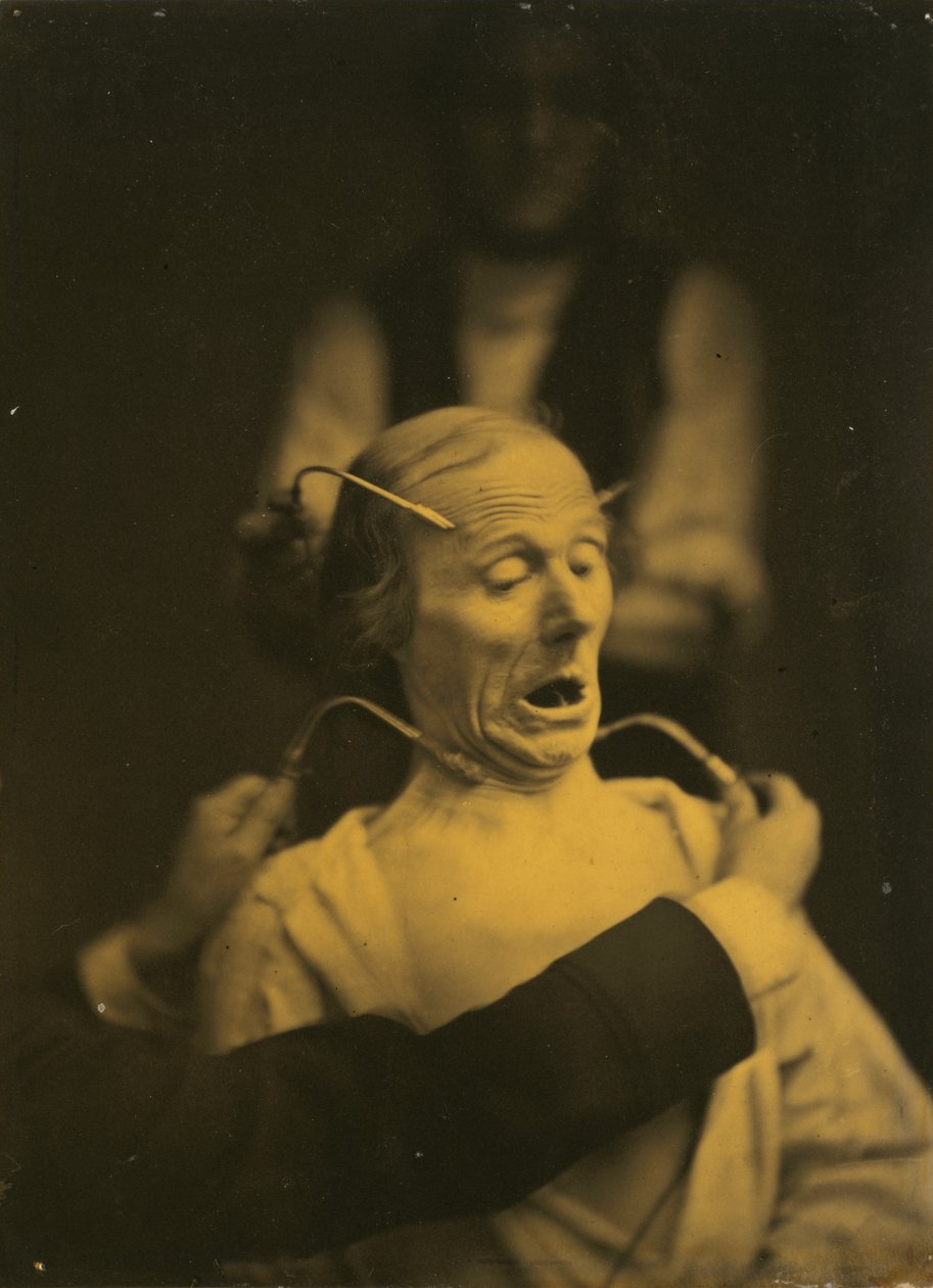 Udtryk for terror af Guillaume Benjamin Amant Duchenne