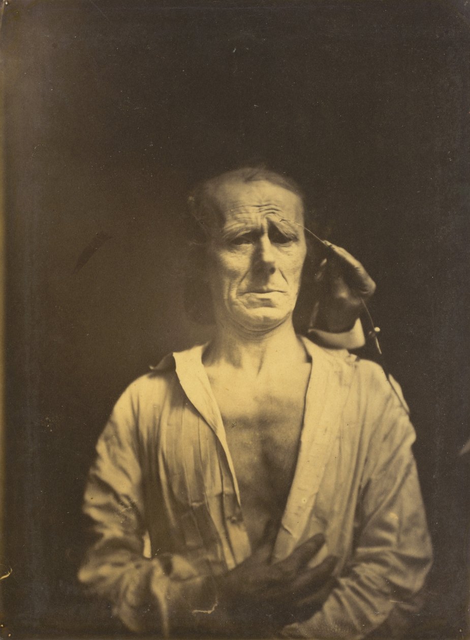 Spasmer af m. corrugator supercilii under meget stærkt lys (venstre); Et afslappet ansigt (fotograferet i fuld solskin) (til højre) af Guillaume Benjamin Amant Duchenne