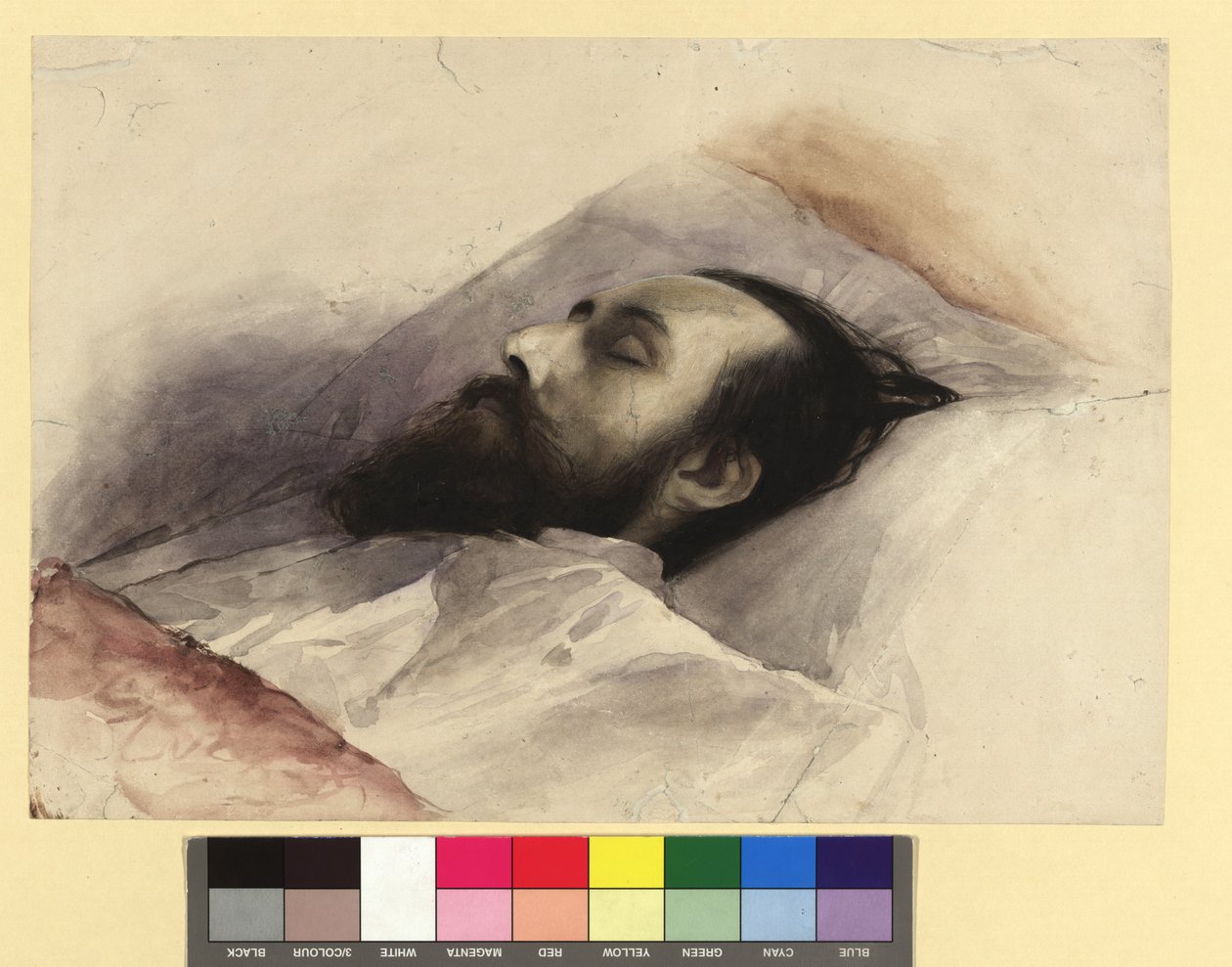Julius Lott (1836–1883) på sit dødsleje af Gustav Klimt