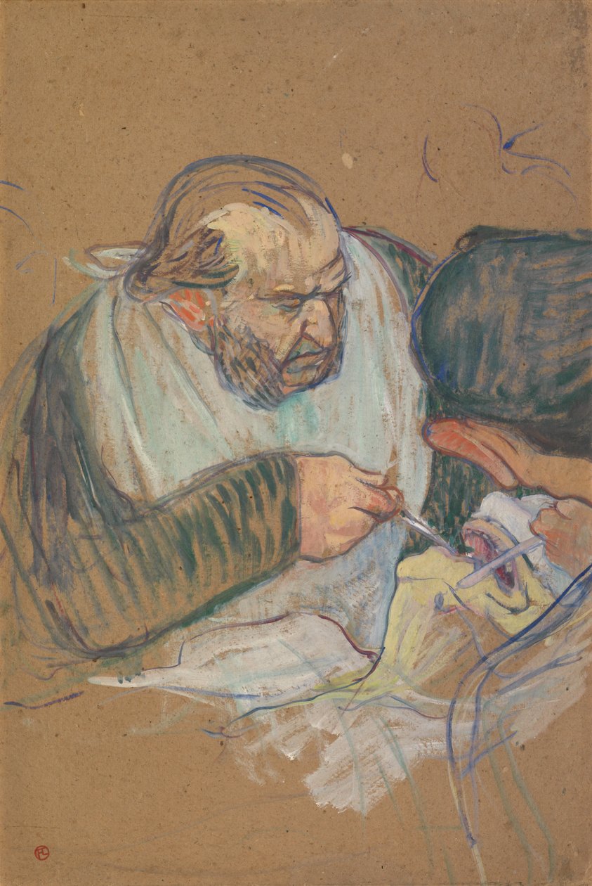 Dr. Péan opererer af Henri de Toulouse-Lautrec